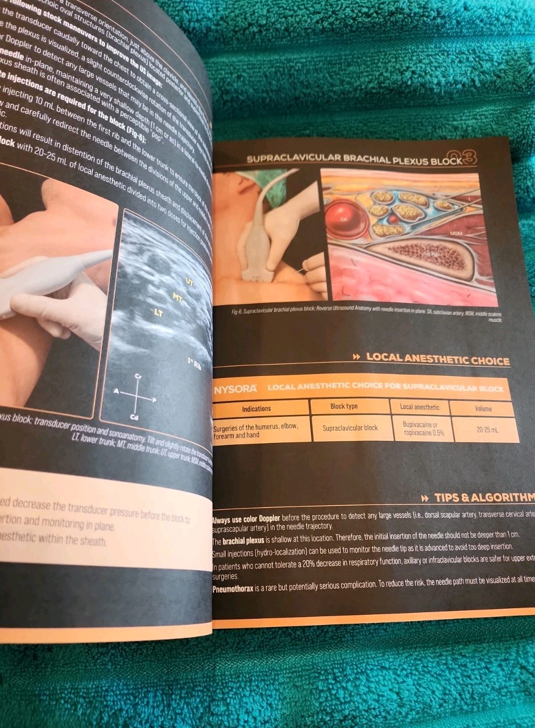 Nysora Nerve Block Manual Prof. Dr. Admir Hadzic 2023 NEW