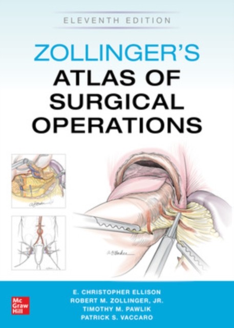 ZOLLINGERS ATLAS OF SURGICAL OPERATIONS by Robert Zollinger Paperback Self Help